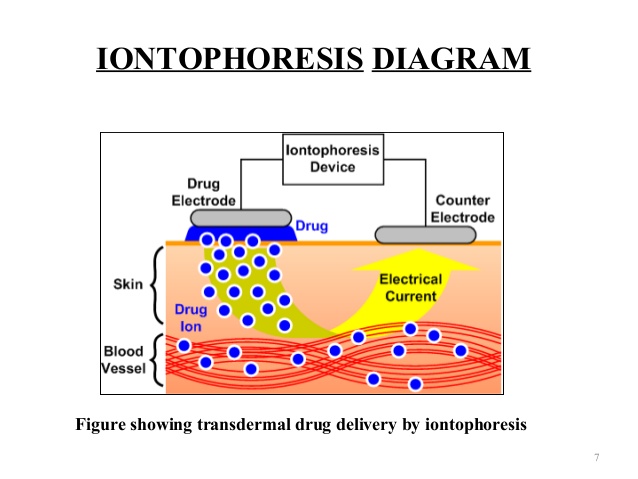 Iontophoresis – THIẾT BỊ KHOA HỌC CÔNG NGHỆ